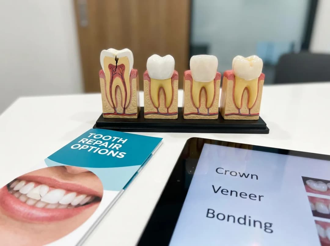 What to Do for a Chipped, Cracked, or Broken Tooth: Repair Options & Immediate Action